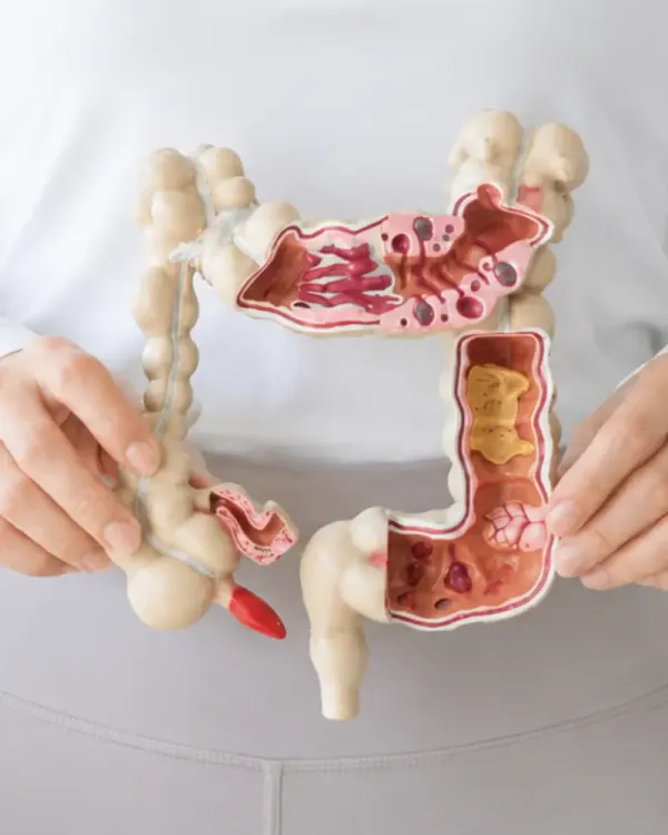 Raciocínio Clínico Intestinal Descomplicado